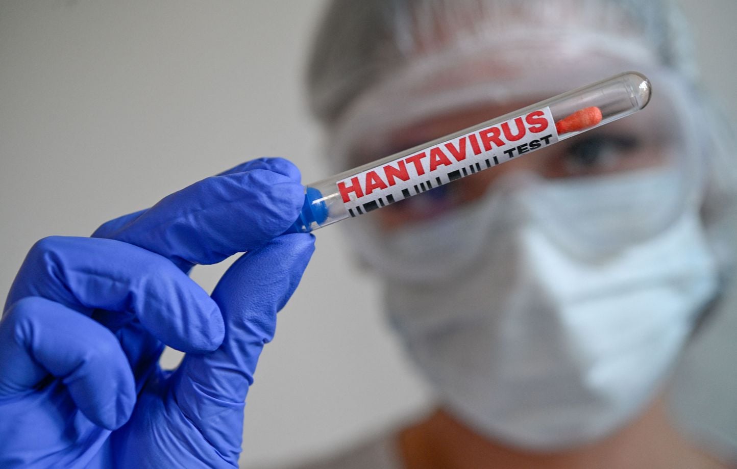 Regreso a Francia este domingo de los franceses del barco afectado por el hantavirus Regreso a Francia este domingo de los franceses del barco afectado por el hantavirus